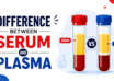 Difference Between Serum and Plasma